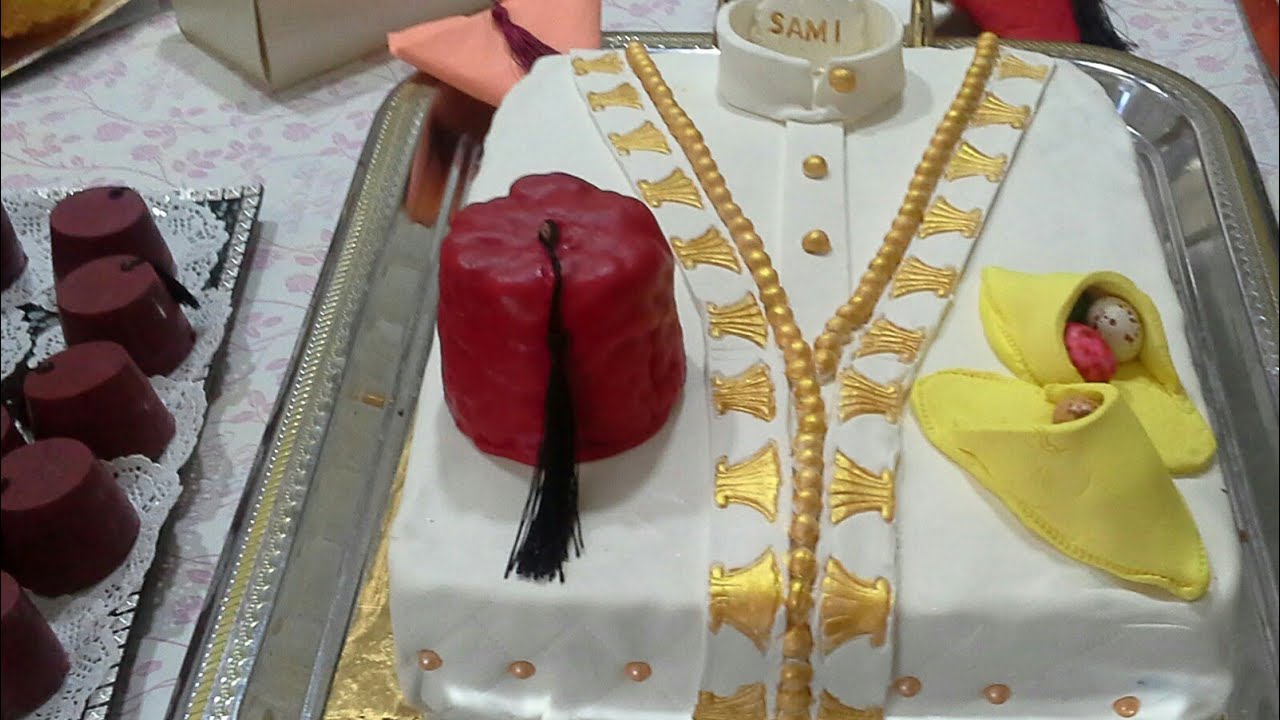 وزارة الصحة تذكر بشروط الختان