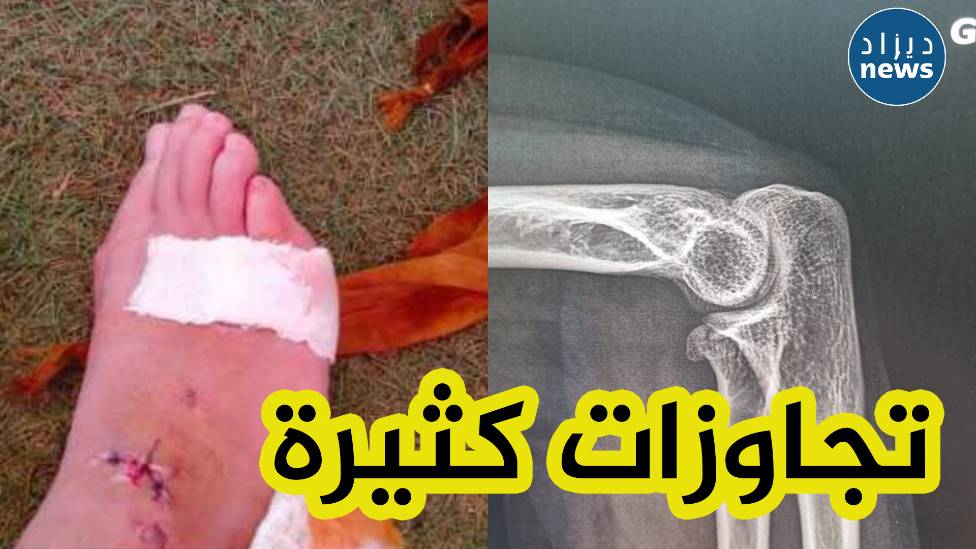زبدي يبدي استيائه من التجاوزات في مستلزمات السلامة في بعض المسابح